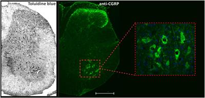 Neuroprotection by upregulation of the major histocompatibility complex class I (MHC I) in SOD1G93A mice